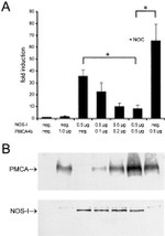 nNOS Antibody in Western Blot (WB)