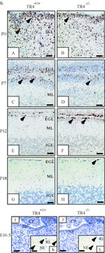 BrdU Antibody in Immunohistochemistry (IHC)