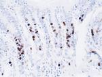 BrdU Antibody in Immunohistochemistry (IHC)