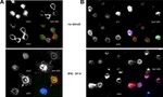 Annexin A2 Antibody in Immunocytochemistry (ICC/IF)