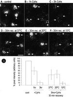 Caveolin 1 Antibody in Immunocytochemistry (ICC/IF)