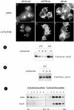 Caveolin 1 Antibody in Western Blot, Immunocytochemistry, Immunoprecipitation (WB, ICC/IF, IP)