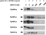 Phosphotyrosine Antibody in Western Blot (WB)