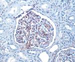 CD34 Antibody in Immunohistochemistry (IHC)