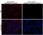 CD56 Antibody in Immunohistochemistry (Paraffin) (IHC (P))