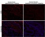 CD56 Antibody in Immunohistochemistry (Paraffin) (IHC (P))