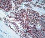 CD56 Antibody in Immunohistochemistry (IHC)