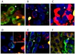 CD34 Antibody in Immunohistochemistry (IHC)