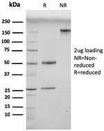 N-Cadherin/Cadherin-2/CD325 (NCAD) Antibody in SDS-PAGE (SDS-PAGE)