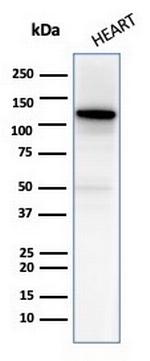 N-Cadherin/Cadherin-2/CD325 (NCAD) Antibody in Western Blot (WB)