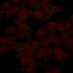 N-Cadherin/Cadherin-2/CD325 (NCAD) Antibody in SDS-PAGE (SDS-PAGE)