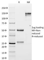 N-Cadherin/Cadherin-2/CD325 (NCAD) Antibody in SDS-PAGE (SDS-PAGE)