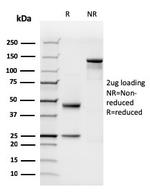 N-Cadherin/Cadherin-2/CD325 (NCAD) Antibody in SDS-PAGE (SDS-PAGE)