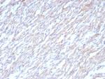 N-Cadherin/Cadherin-2/CD325 (NCAD) Antibody in Immunohistochemistry (Paraffin) (IHC (P))