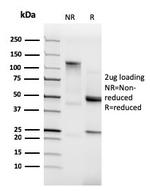 N-Cadherin/Cadherin-2/CD325 (NCAD) Antibody in SDS-PAGE (SDS-PAGE)