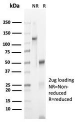 N-Cadherin/Cadherin-2/CD325 (NCAD) Antibody in SDS-PAGE (SDS-PAGE)