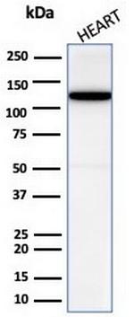 N-Cadherin/Cadherin-2/CD325 (NCAD) Antibody in Western Blot (WB)