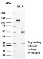 N-Cadherin/Cadherin-2/CD325 (NCAD) Antibody in SDS-PAGE (SDS-PAGE)