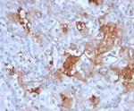 Cadherin-6 (CDH6)/K-Cadherin Antibody in Immunohistochemistry (Paraffin) (IHC (P))