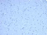 TOM1L1 (Target of Myb1 Like 1 Membrane Trafficking Protein) Antibody in Immunohistochemistry (Paraffin) (IHC (P))