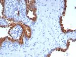 PTPRU Antibody in Immunohistochemistry (Paraffin) (IHC (P))