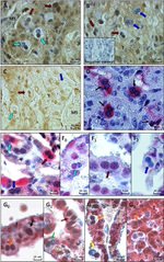 Glucocorticoid Receptor Antibody in Immunohistochemistry (IHC)