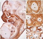 Versican V0, V1 Neo Antibody in Immunohistochemistry (IHC)