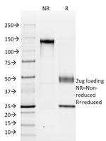 Ksp-Cadherin (Kidney-Specific Cadherin)/CDH16 Antibody in SDS-PAGE (SDS-PAGE)