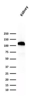 Ksp-Cadherin (Kidney-Specific Cadherin)/CDH16 Antibody in Western Blot (WB)