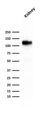 Ksp-Cadherin (Kidney-Specific Cadherin)/CDH16 Antibody in Western Blot (WB)