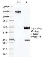 Ksp-Cadherin/ CDH16 (Renal Cell Marker) Antibody in SDS-PAGE (SDS-PAGE)