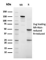 Ksp-Cadherin/CDH16 Antibody in SDS-PAGE (SDS-PAGE)