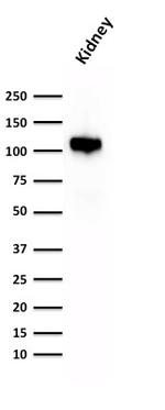 Ksp-Cadherin (Kidney-Specific Cadherin)/CDH16 Antibody in Western Blot (WB)