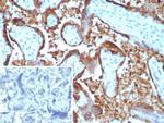 EBI3/Epstein-Barr virus induced 3 Antibody in Immunohistochemistry (Paraffin) (IHC (P))