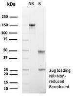 Cadherin 17/LI Cadherin (Liver-Intestine Marker) Antibody in SDS-PAGE (SDS-PAGE)