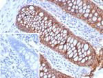 Cadherin 17/LI Cadherin (Liver-Intestine Marker) Antibody in Immunohistochemistry (Paraffin) (IHC (P))