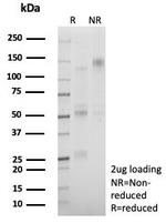 Cadherin 17/LI Cadherin (Liver-Intestine Marker) Antibody in SDS-PAGE (SDS-PAGE)