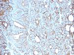 Cadherin 17/LI Cadherin (Liver-Intestine Marker) Antibody in Immunohistochemistry (Paraffin) (IHC (P))