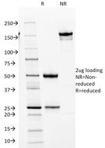 Cdk2/p34cdc2 Serine-Threonine Kinase Antibody in SDS-PAGE (SDS-PAGE)