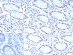 CDK4 Antibody in Immunohistochemistry (Paraffin) (IHC (P))