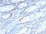 CDK4 Antibody in Immunohistochemistry (Paraffin) (IHC (P))