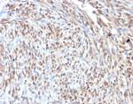 CDK4 Antibody in Immunohistochemistry (Paraffin) (IHC (P))