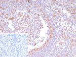 CDK4 Antibody in Immunohistochemistry (Paraffin) (IHC (P))