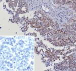 CDK4 Antibody in Immunohistochemistry (Paraffin) (IHC (P))