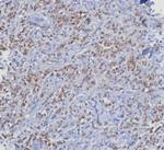 CDK4 Antibody in Immunohistochemistry (Paraffin) (IHC (P))