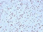 OLIG2 (Marker of Glial Brain Tumors) Antibody in Immunohistochemistry (Paraffin) (IHC (P))