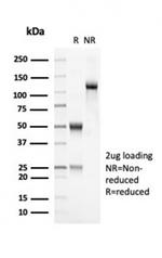 OLIG2 (Marker of Glial Brain Tumors) Antibody in SDS-PAGE (SDS-PAGE)