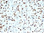 OLIG2 (Marker of Glial Brain Tumors) Antibody in Immunohistochemistry (Paraffin) (IHC (P))