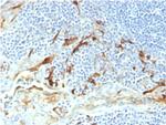 Mesothelin (Mesothelial Marker) Antibody in Immunohistochemistry (Paraffin) (IHC (P))