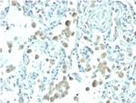 Mesothelin (Mesothelial Marker) Antibody in Immunohistochemistry (Paraffin) (IHC (P))